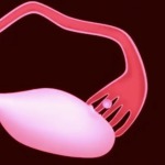 Thumbnail of post image 003